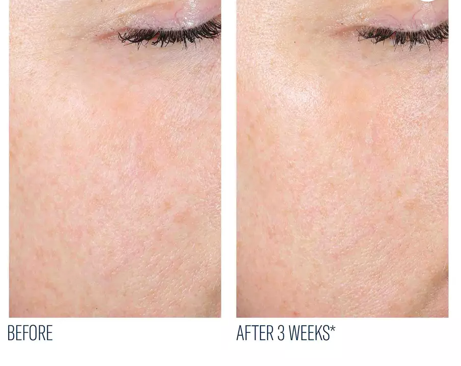 Skinbetter Science AlphaRet Exfoliating Peel Pads (3)
